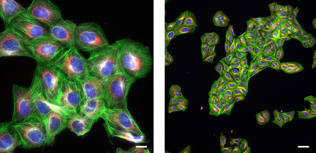 High resolution, high magnification images of U2OS human osteosarcoma cells, stained with DAPI (nuclei, blue), Alexa Fluor 488 Phalloidin (F‑actin, green), MitoTracker Red (mitochondria, red), and Alexa Fluor 647 Anti‑tubulin (tubulin, white)