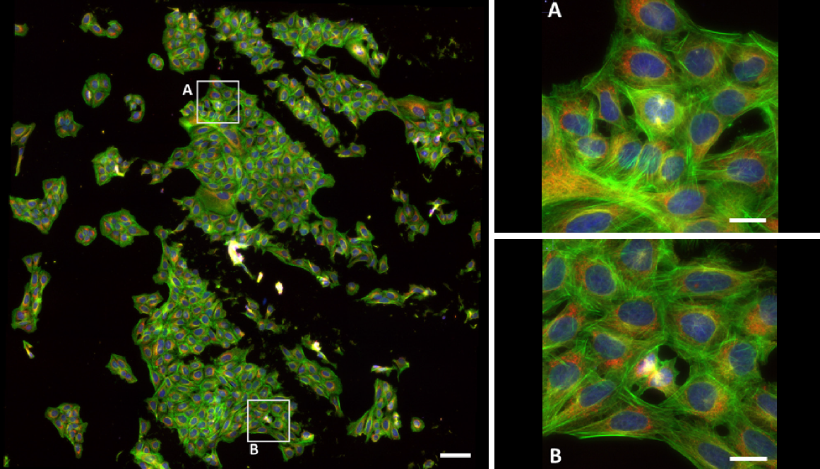 Large field of view (FOV) image of U2OS human osteosarcoma cells stained with DAPI (nuclei, blue), Alexa Fluor 488 Phalloidin (F‑actin, green), MitoTracker Red (mitochondria, red), and Alexa Fluor 647 Anti‑tubulin (tubulin, white)