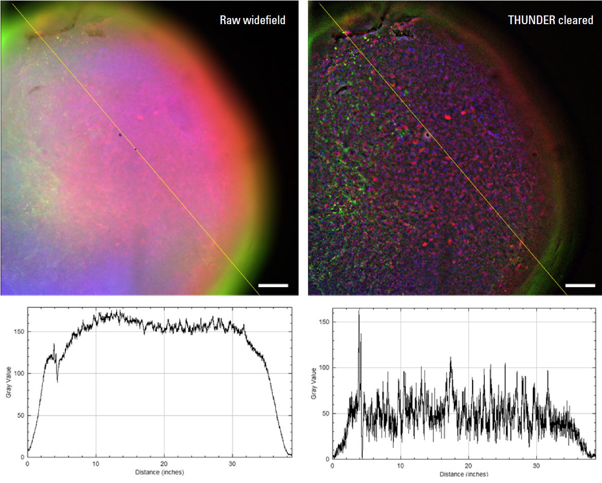Large FOV 2D slices of a 1 mm diameter midbrain neural organoid stained with DAPI (blue, nuclear stain), &beta;‑tubulin (green, neuronal stain), and GFAP&nbsp;(red, astrocyte stain)