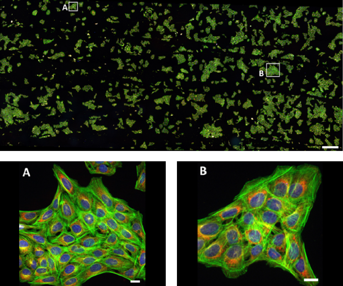 Large field of view (FOV) image of U2OS human osteosarcoma cells stained with DAPI (nuclei, blue), Alexa Fluor 488 Phalloidin (F‑actin, green), MitoTracker Red (mitochondria, red), and Alexa Fluor 647 Anti‑tubulin (tubulin, white).