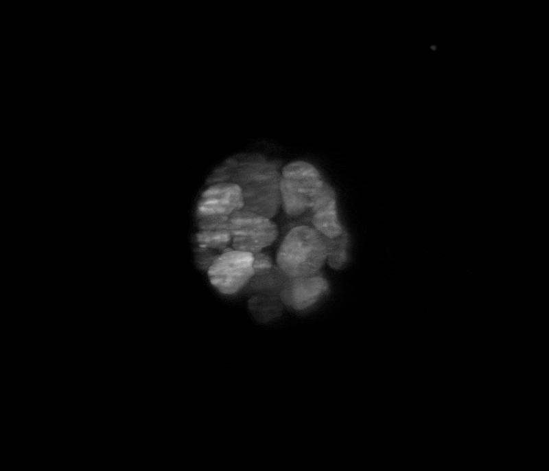 Cancer organoid 3D.gif