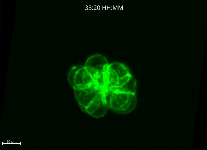 mES_Exp47_pos03_with_scales_3D-ezgif.com-optimize.gif