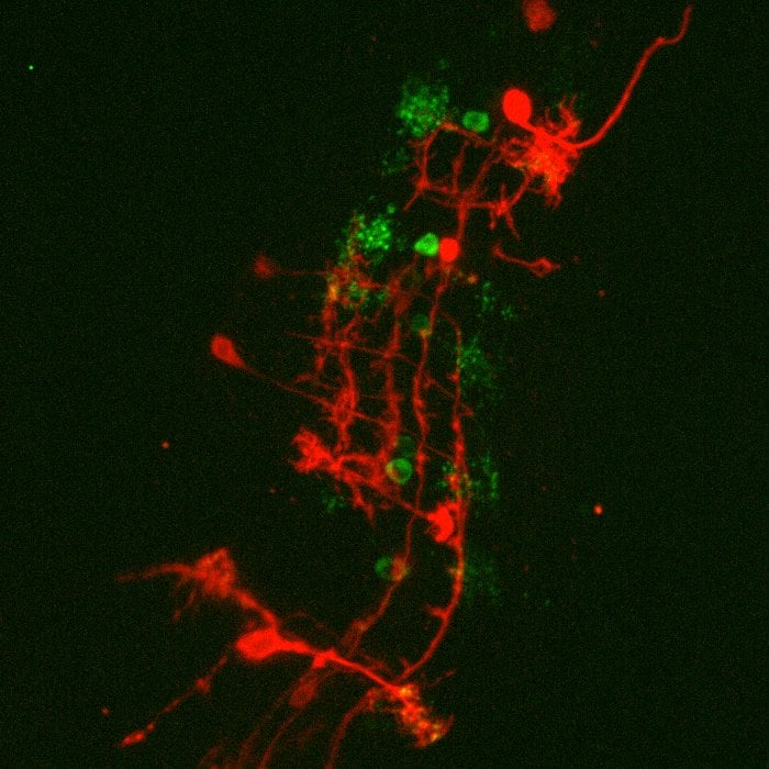 Live-Cell-Spinning-Disk-Heidelberg.png