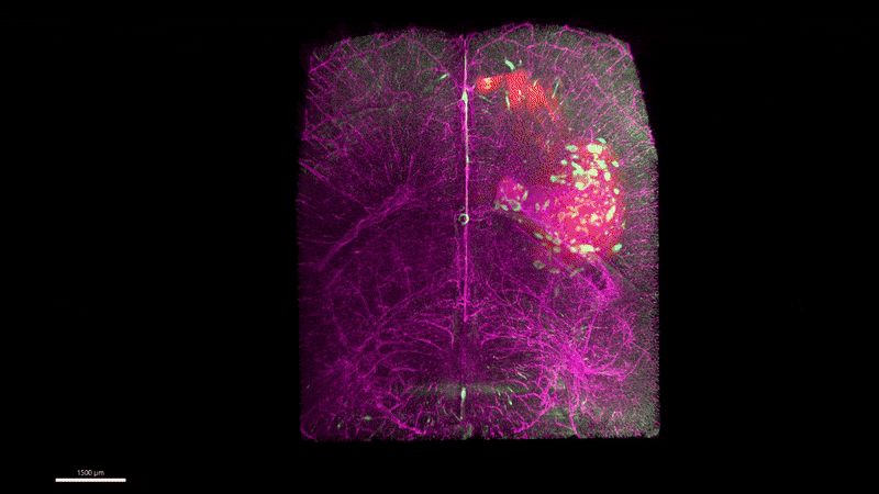 smallbrain_slow-ezgif.com-optimize.gif