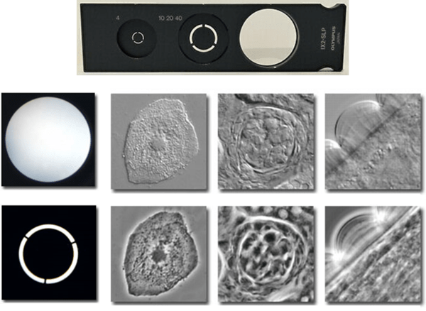 What Is Widefield Imaging_images-2.png