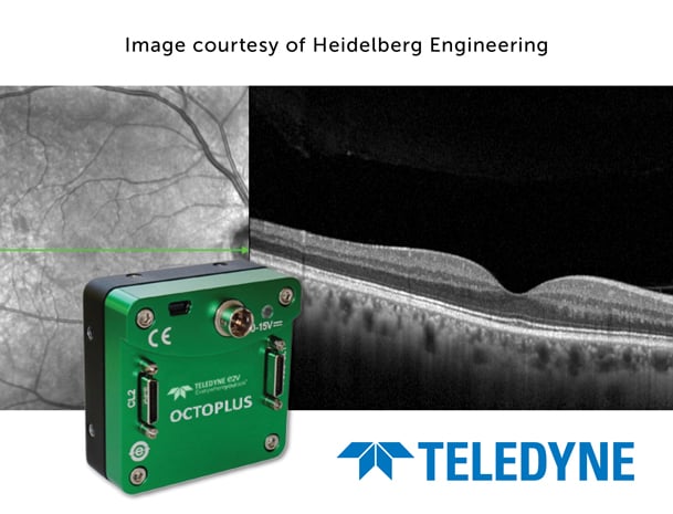 2025-06-05_TDY-e2v_OctPlus-Website-Graphic_609x465.jpg